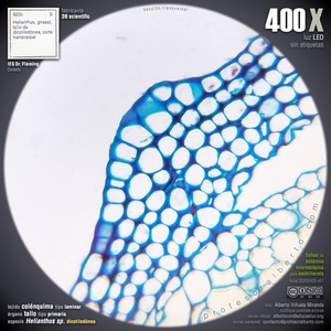 Colénquima Colénquima